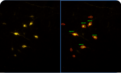 Neuronal Cell Detection